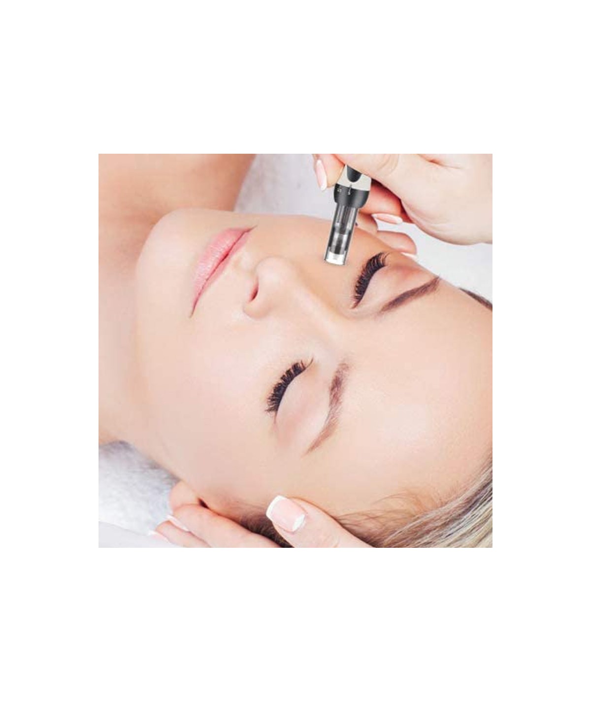 Micropunción Anti Edad (Efecto Bótox) Dermapen